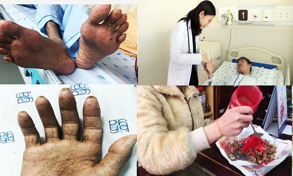 asen la gi 1 - Asen là gì? Một số phương pháp lọc nước ô nhiễm asen phổ biến Asen là gì? Một số phương pháp lọc nước ô nhiễm asen phổ biến
